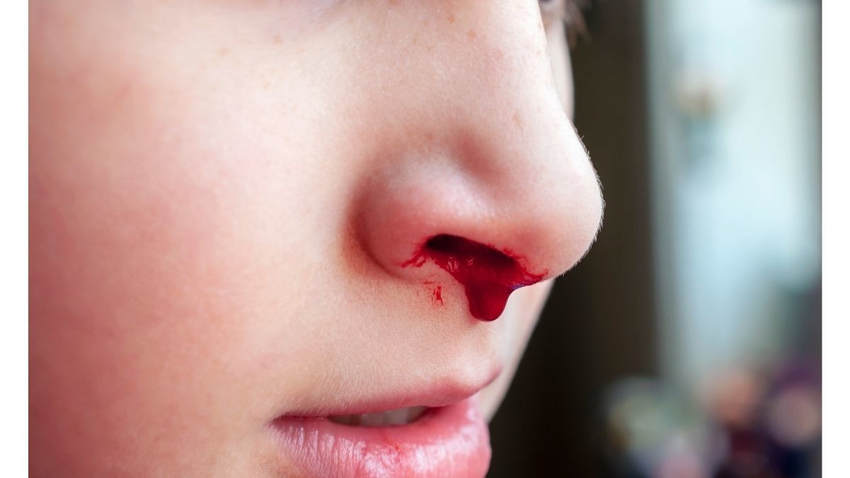 Pilihan Makanan untuk Anak yang Sering Mimisan