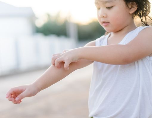 Kenali 6 Jenis Penyakit Kulit yang Sering Dialami Anak
