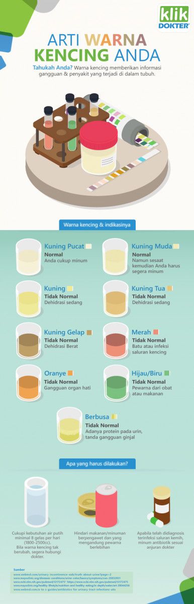 Mengetahui Kondisi Kesehatan dari Warna Urine