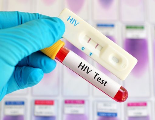 Panduan Menjalani Tes HIV di Puskesmas