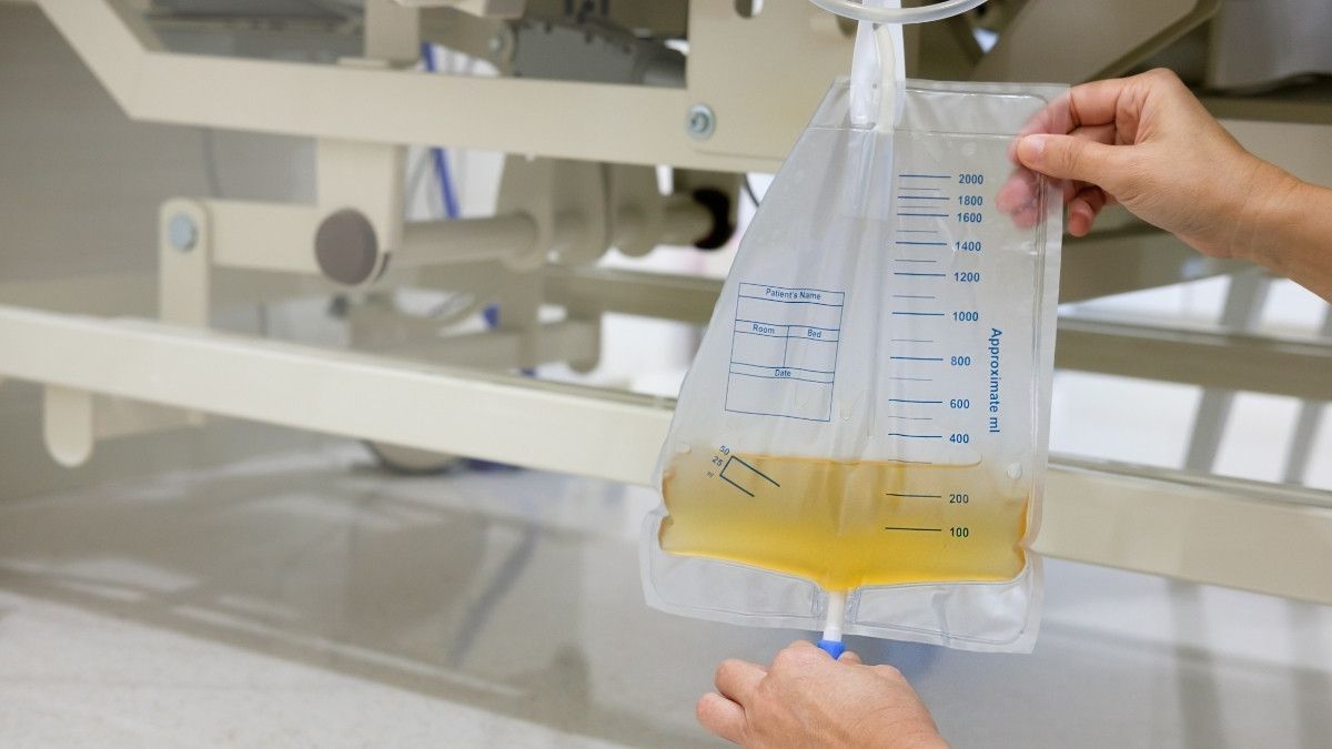 Fungsi dan Cara Kerja Alat Kateter Urine