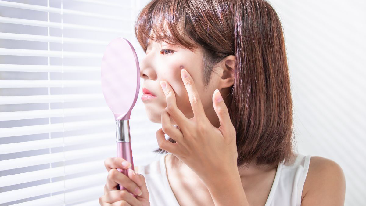 Povidone Iodine untuk Jerawat, Apakah Aman?