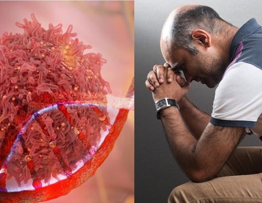 Awas! Ini Kanker yang Sering Terjadi pada Pria