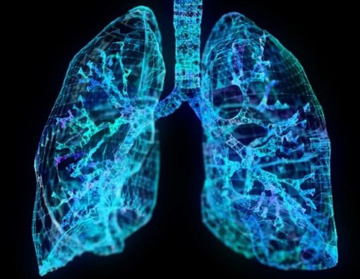 Mengenal Torakosintesis, Prosedur Sedot Cairan di Paru