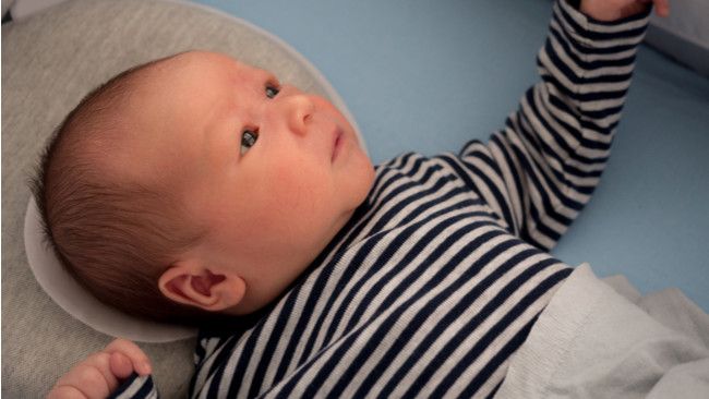 Kepala Peyang pada Bayi, Bisa Diperbaiki?