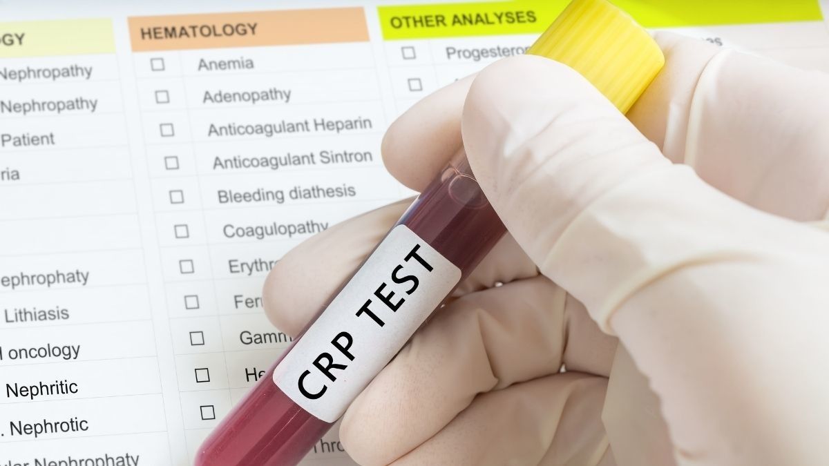 Mengenal Tes CRP (C-Reactive Protein) untuk Mendeteksi Penyakit