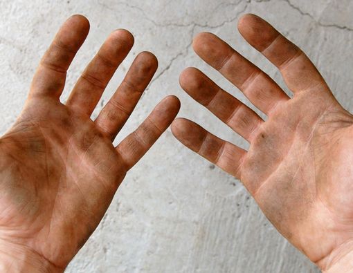 Ini Akibatnya Kalau Malas Cuci Tangan