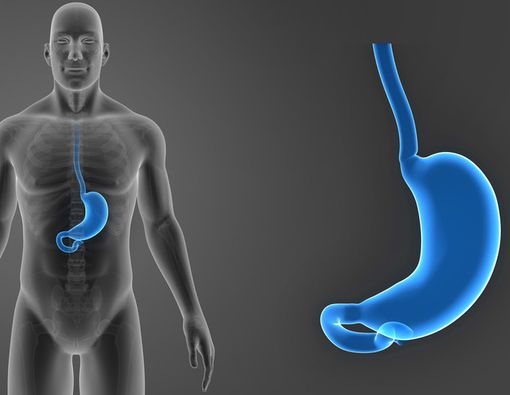 Pengecilan Lambung, Solusi bagi Kasus Obesitas Wanita 350 kg?