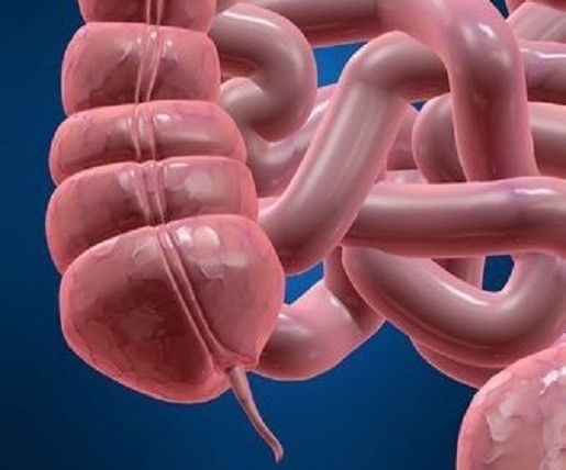 Seluk Beluk Sakit Usus Buntu - KlikDokter