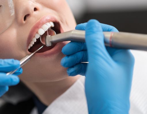 Ini Manfaat Penting Ke Dokter Gigi