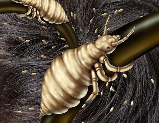 Penyebab Kulit Gatal 