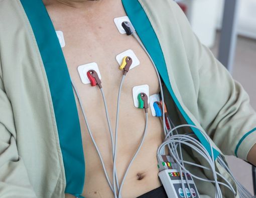 Mengenal Elektrokardiogram (EKG), dari Fungsi Hingga Prosedurnya