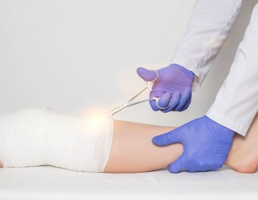 Cedera Tulang Kering, Apa Tanda dan Penanganannya?