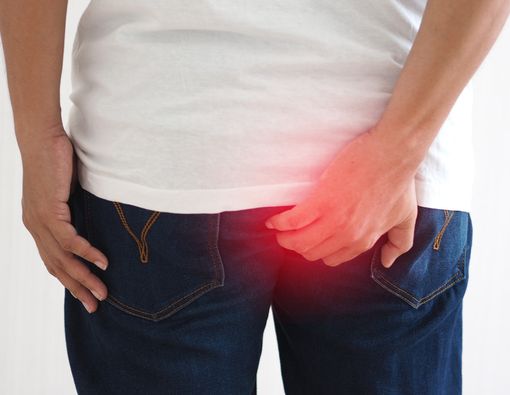 Bengkak di Anus? Waspadai Gejala Abses Anus