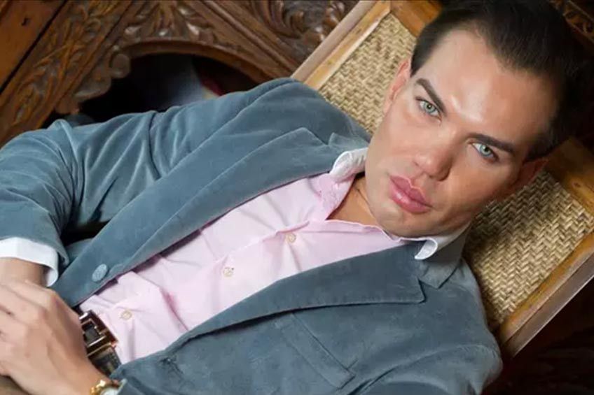 Rodrigo Alves, Pria Pecandu Operasi Plastik