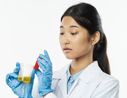 Hasil Tes Urine Epitel Positif, Apa Artinya dalam Medis?