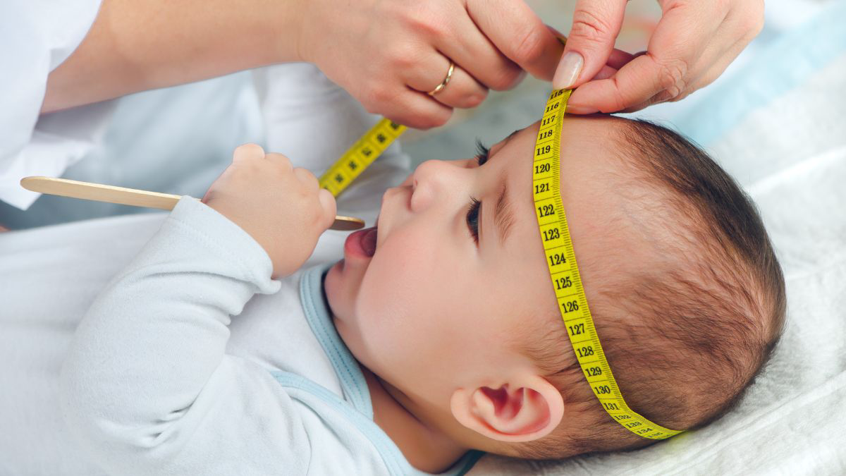 Orangtua Harus Tahu, Ini Ciri Bentuk Kepala Bayi yang Normal