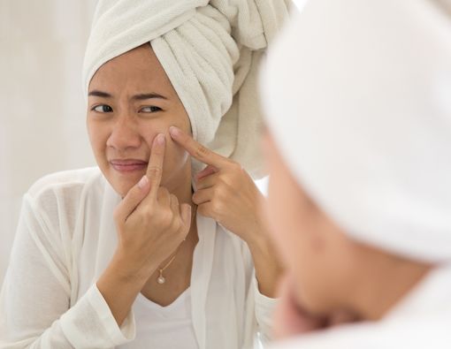 Mengapa Hidrokuinon Digunakan pada Skincare dan Cara Atasi Efeknya