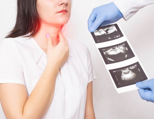 Kanker Tiroid Lebih Sering Terjadi pada Wanita, Kenapa?