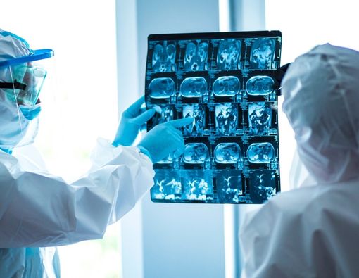 Wajib Tahu, Ini Organ Tubuh yang Terdampak Virus Corona