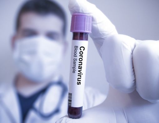 Mungkinkah Ada Orang yang Kebal Virus Corona? Ini Faktanya!