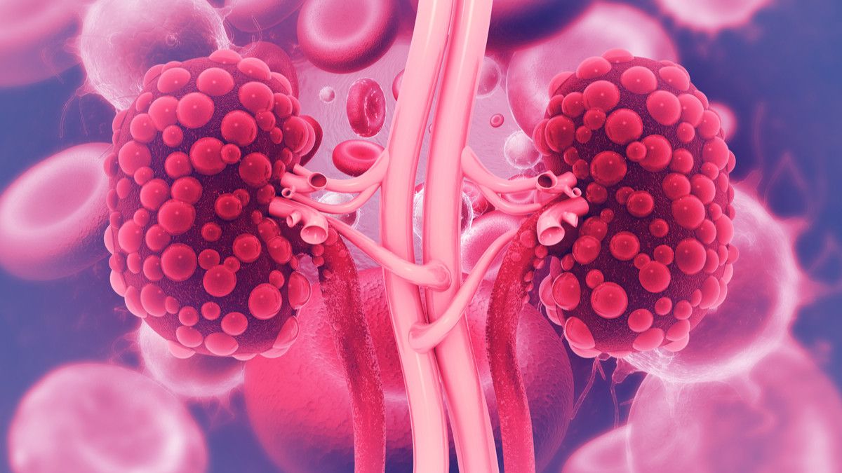 Harus Tahu, Ini 5 Persiapan Operasi Cangkok Ginjal