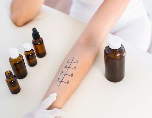 Mengenal Prosedur Tes Alergi untuk si Kecil