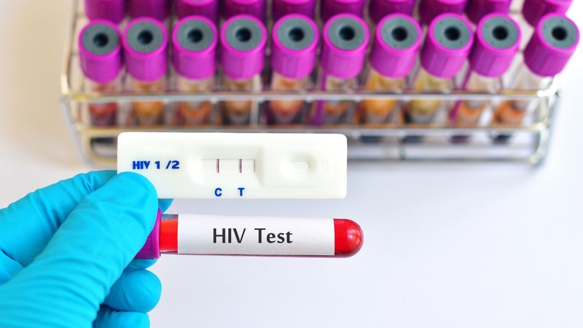 Waktu Tepat Tes HIV Setelah Berhubungan Tanpa Pelindung