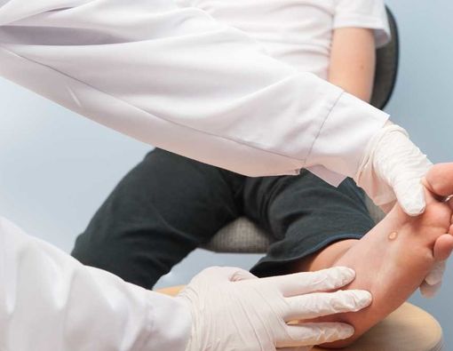 Cara Mengobati Kutil Periungual di Jari Tangan dan Kaki