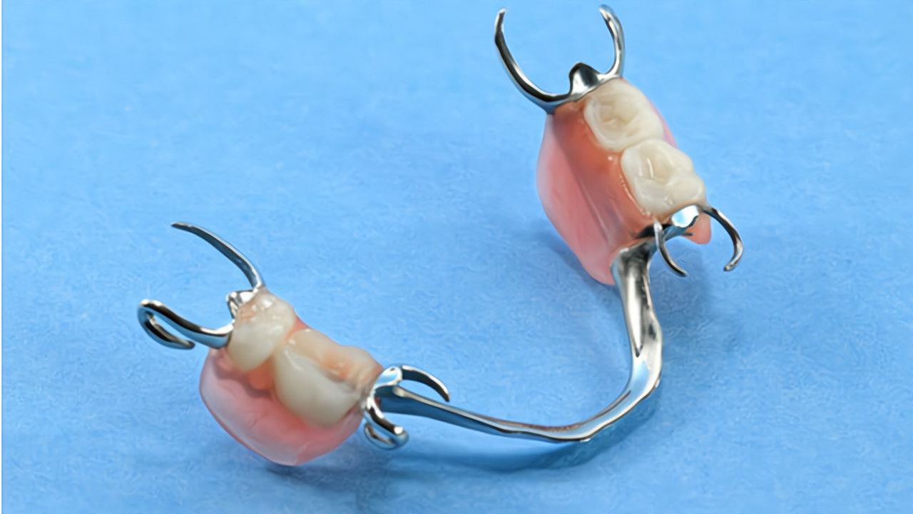 Tips Merawat Gigi Palsu Lepasan agar Tidak Bau