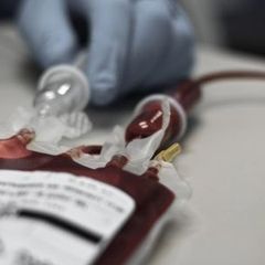 Apa Itu Anemia Aplastik?