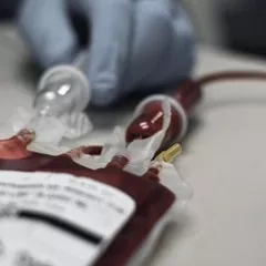 Apa Itu Anemia Aplastik?