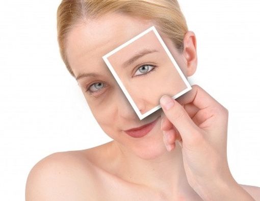 4 Tips Solusi Lingkaran Hitam Mata