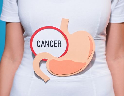Kanker Lambung