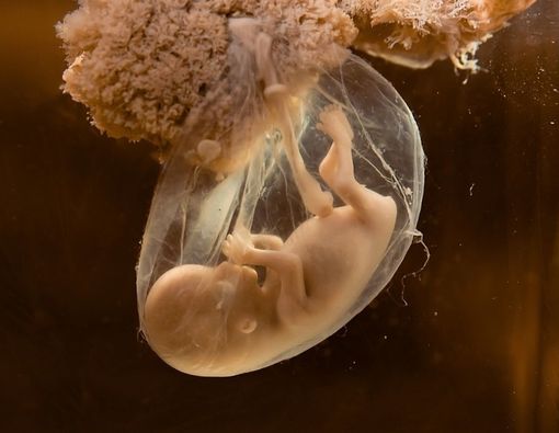 Penyebab Posisi Janin Berpindah-pindah di Trimester Pertama