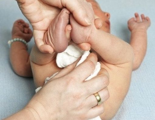 Cara Mengatasi Ruam Popok