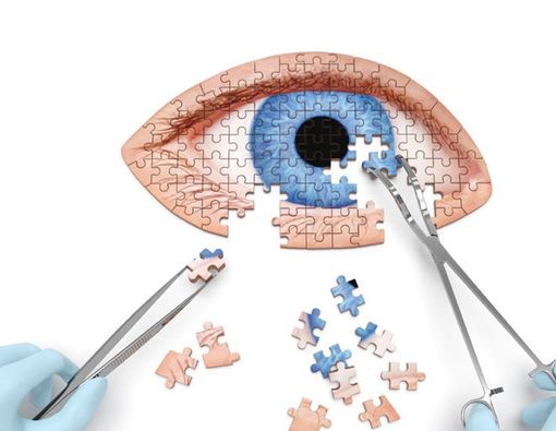 5 Hal untuk Mencegah Anak Terkena Katarak