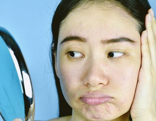 Intip Perawatan Dokter Spesialis Kulit untuk Atasi Kekusaman!