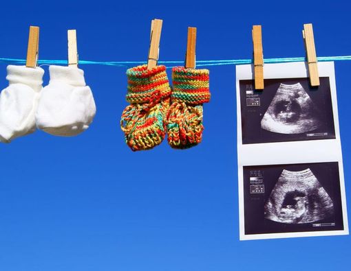 Cara Mengetahui Jika Bayi Anda Kembar