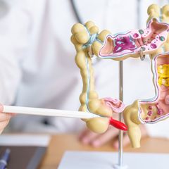 Mengenal Kanker Kolorektal dan Apakah Bisa Sembuh?