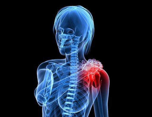 Cegah dan Atasi Radang Sendi Bahu