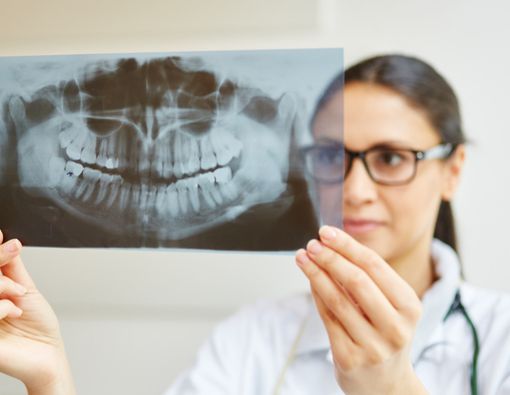 Pahami Prosedur Rontgen Gigi, dari Manfaat Hingga Risikonya