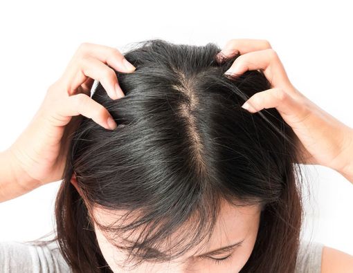 Fakta Tentang Kutu Rambut yang Anda Harus Tahu
