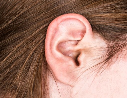 Penyebab Komedo di Telinga dan Cara Mengatasinya
