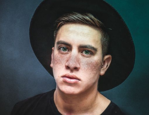 Efek Samping Fake Freckles Berbahan Henna bagi Kulit