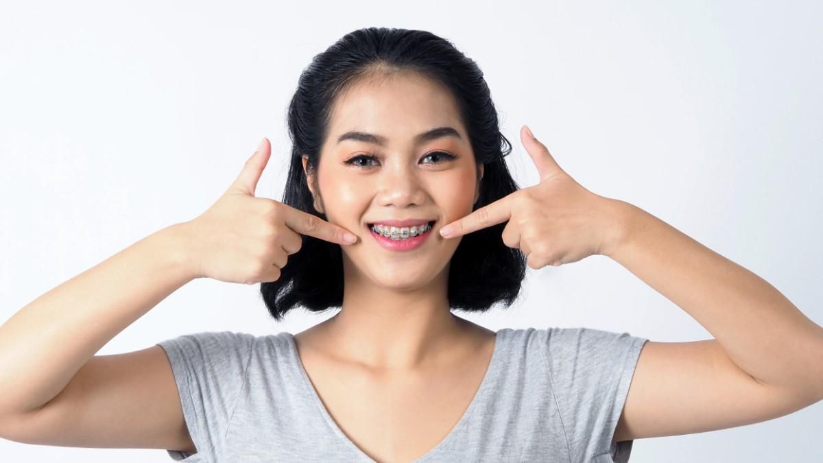 10 Kondisi Gigi yang Perlu Pakai Behel, Apa Saja?