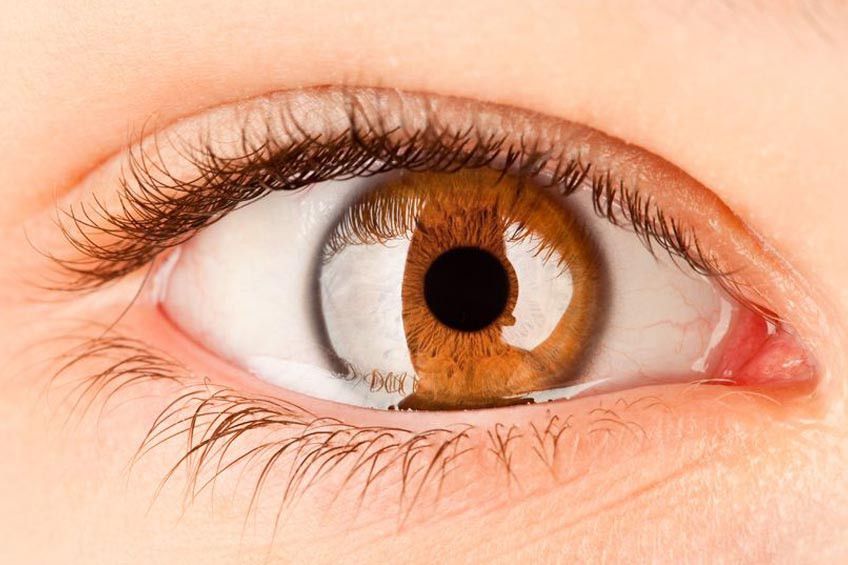 Mata Kedutan, Apa Sebabnya?