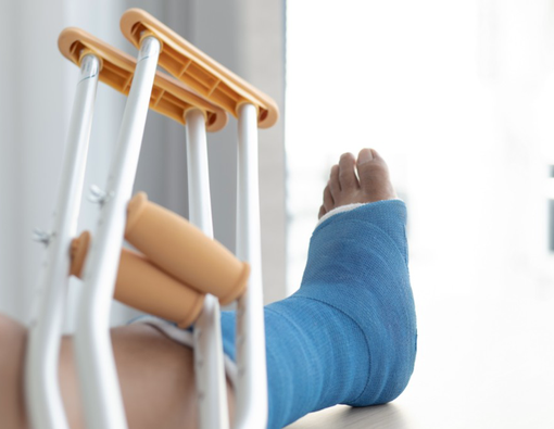 12 Makanan Sehat agar Patah Tulang Pulih Lebih Cepat