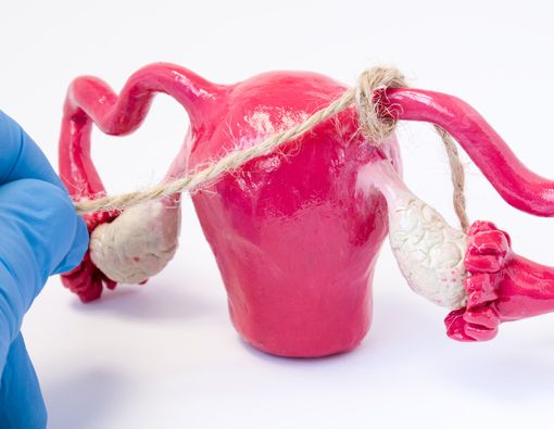 Mengenal Kontrasepsi Tubektomi yang Ampuh Cegah Kehamilan