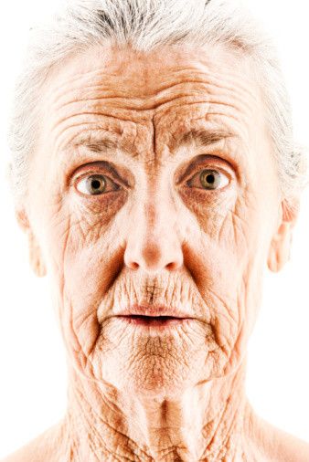 Mendeteksi Gejala Awal Alzheimer 'Tampaknya Mungkin'